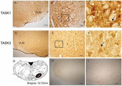 TASK1 and TASK3 Are Coexpressed With ASIC1 in the Ventrolateral Medulla and Contribute to Central Chemoreception in Rats